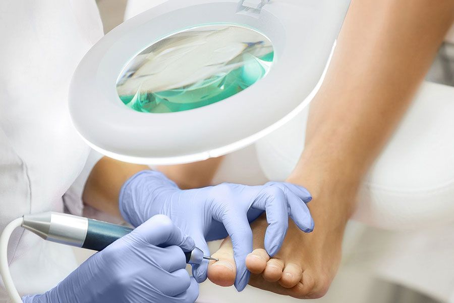 clinica-del-pie-podologo-alcobendas-zulema-martinez-quiropodia