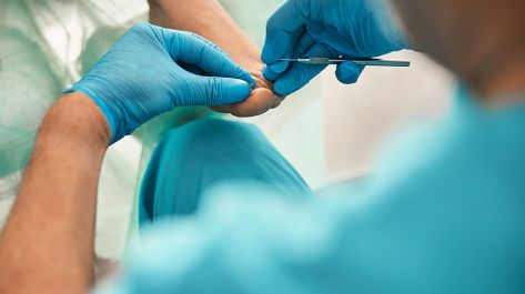 clinica-del-pie-podologo-alcobendas-zulema-martinez-cirugia-podologica-2