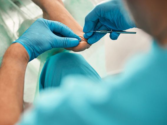 clinica-del-pie-podologo-alcobendas-zulema-martinez-cirugia-podologica-2