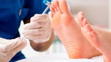 clinica-del-pie-podologo-alcobendas-zulema-martinez-papiloma