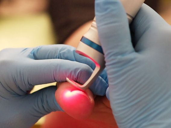 clinica-del-pie-podologo-alcobendas-zulema-martinez-tratamiento-laser