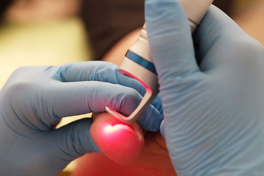clinica-del-pie-podologo-alcobendas-zulema-martinez-tratamiento-laser